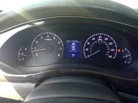 536-50738r Hyundai Passenger Right Caliper Front Sedan Fits 09-14 Genesis 2471911 536-50738r Hyundai Passenger Right Caliper Front Sedan Fits 09-14 Genesis 2471911