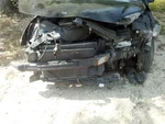 Passenger Caliper Rear Turbo Us Market Fits Sonata 1512612. Fixed Price $89.90.